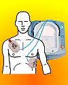 Thumbnail - Defibrillators on American aircraft