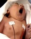 Thumbnail - Youngest UK organ donor