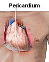 Thumbnail - Heart surgery first pericardium suture