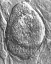 Thumbnail - Stem cells cultured