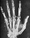 Thumbnail - First British X-ray