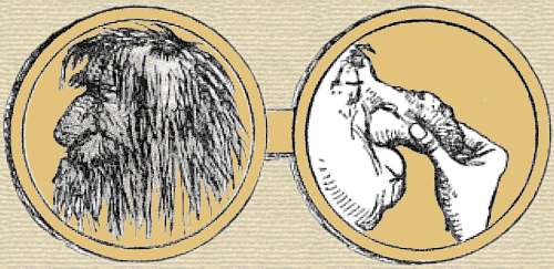 Cartoon medal. Side 1, a filthy face with matted hair. Side 2, man's face with grotesque swollen nose, pinched closed by fingers