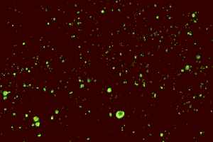 Positive direct fluorescent antibody test shows bright green dots when prepared rabies tissue viewed by fluorescence microscope.